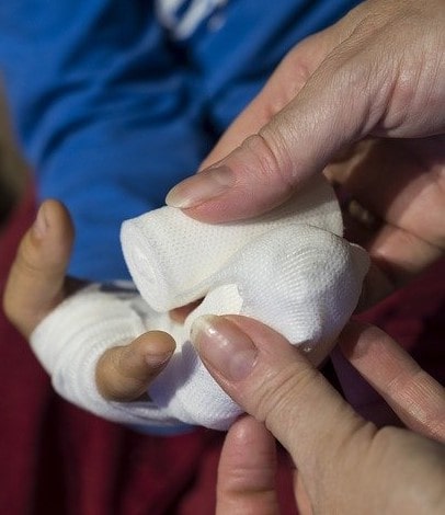 Wounded Fingers are wrapped with Bandage